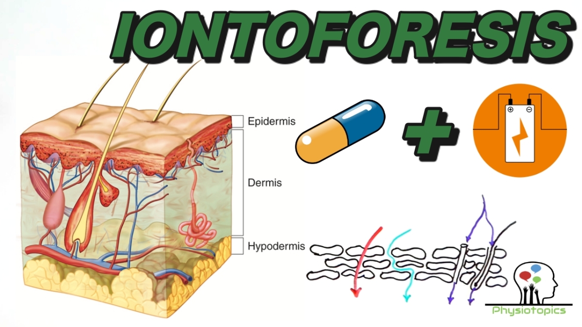 Iontoforesis | Combinando fármacos y corriente eléctrica